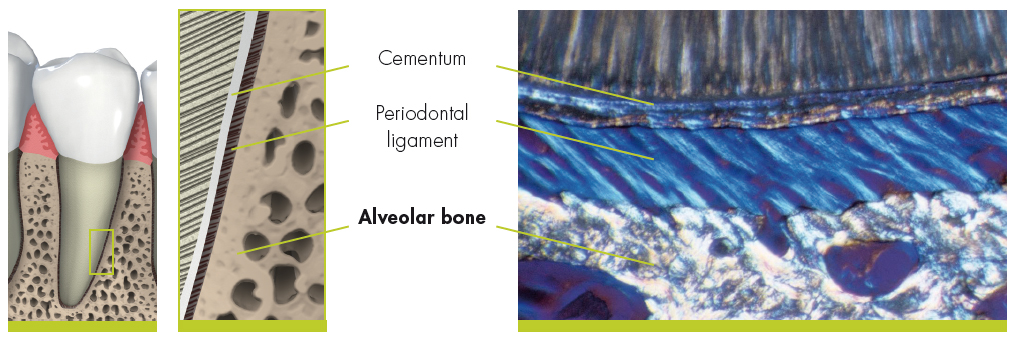 Periodontal Treatment at Dentoplant Clinic