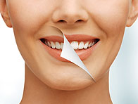 Tooth whitening