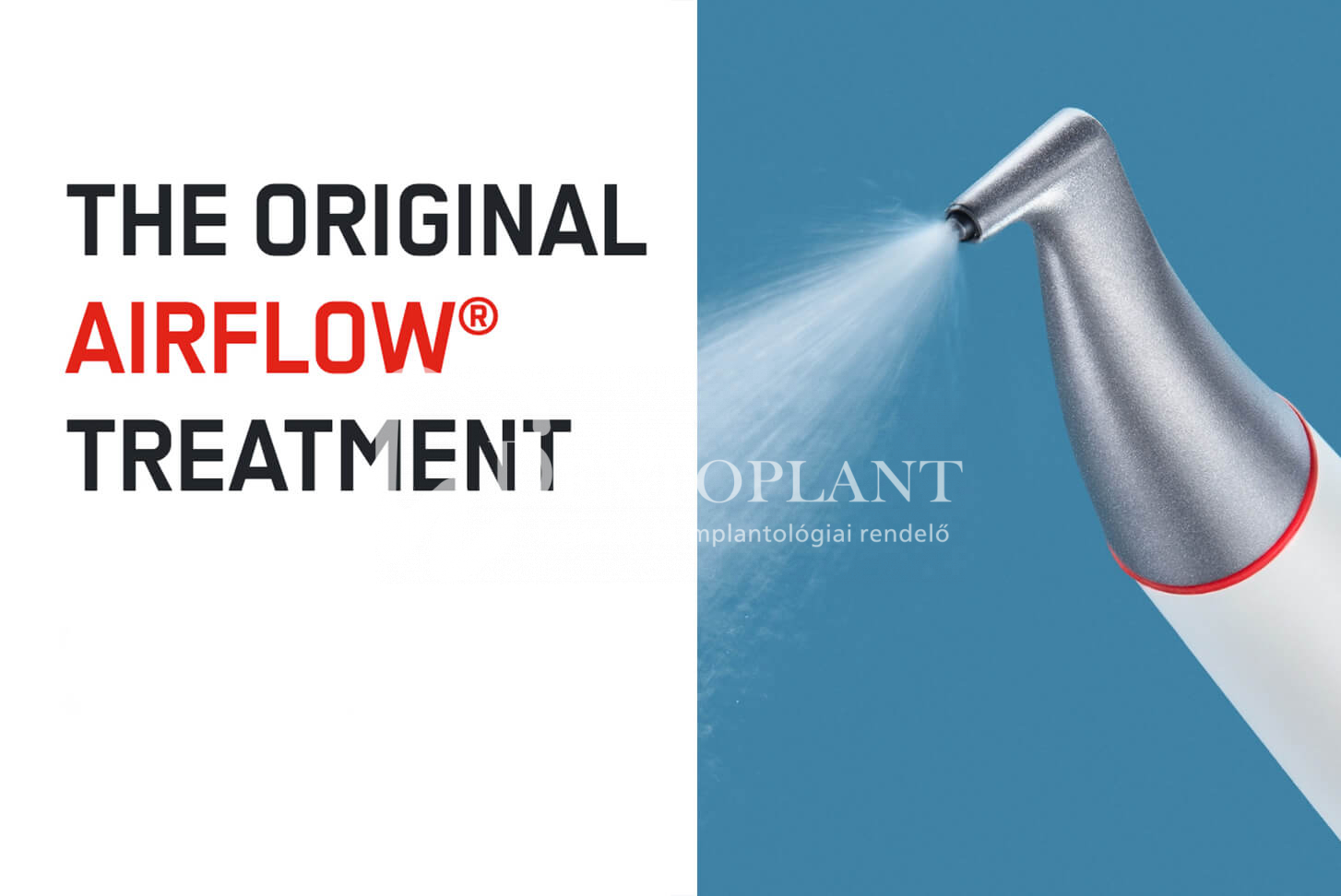 02.Airflow kezelés a Dentoplantnál
