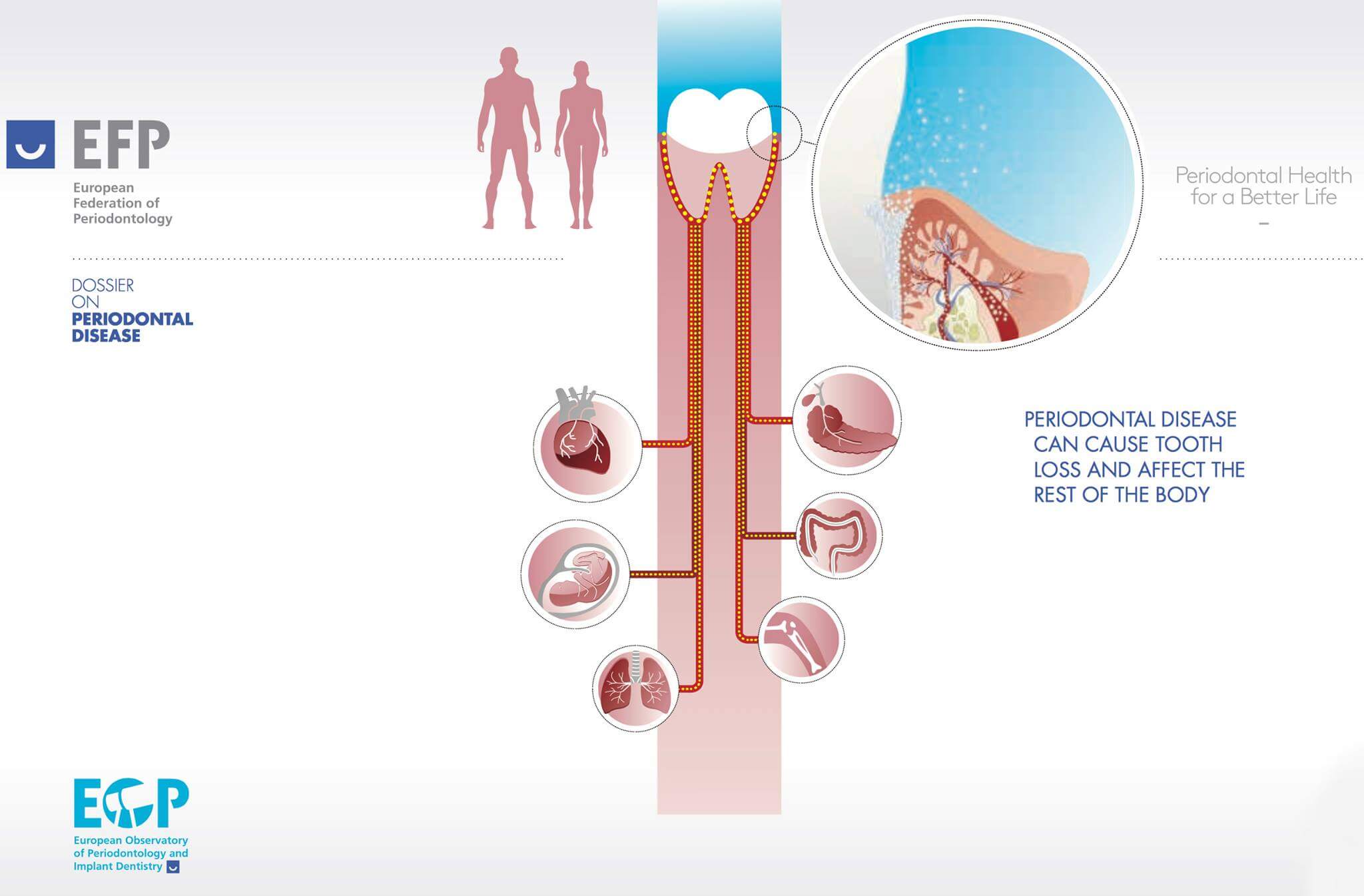periodonts a cukorbetegség és a kezelés