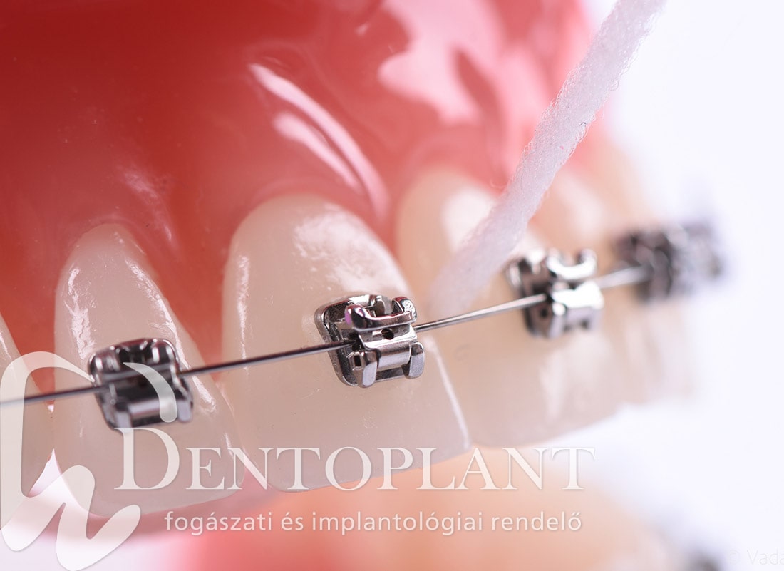 3. Dentoplant Dr. Vadász3.logo-min