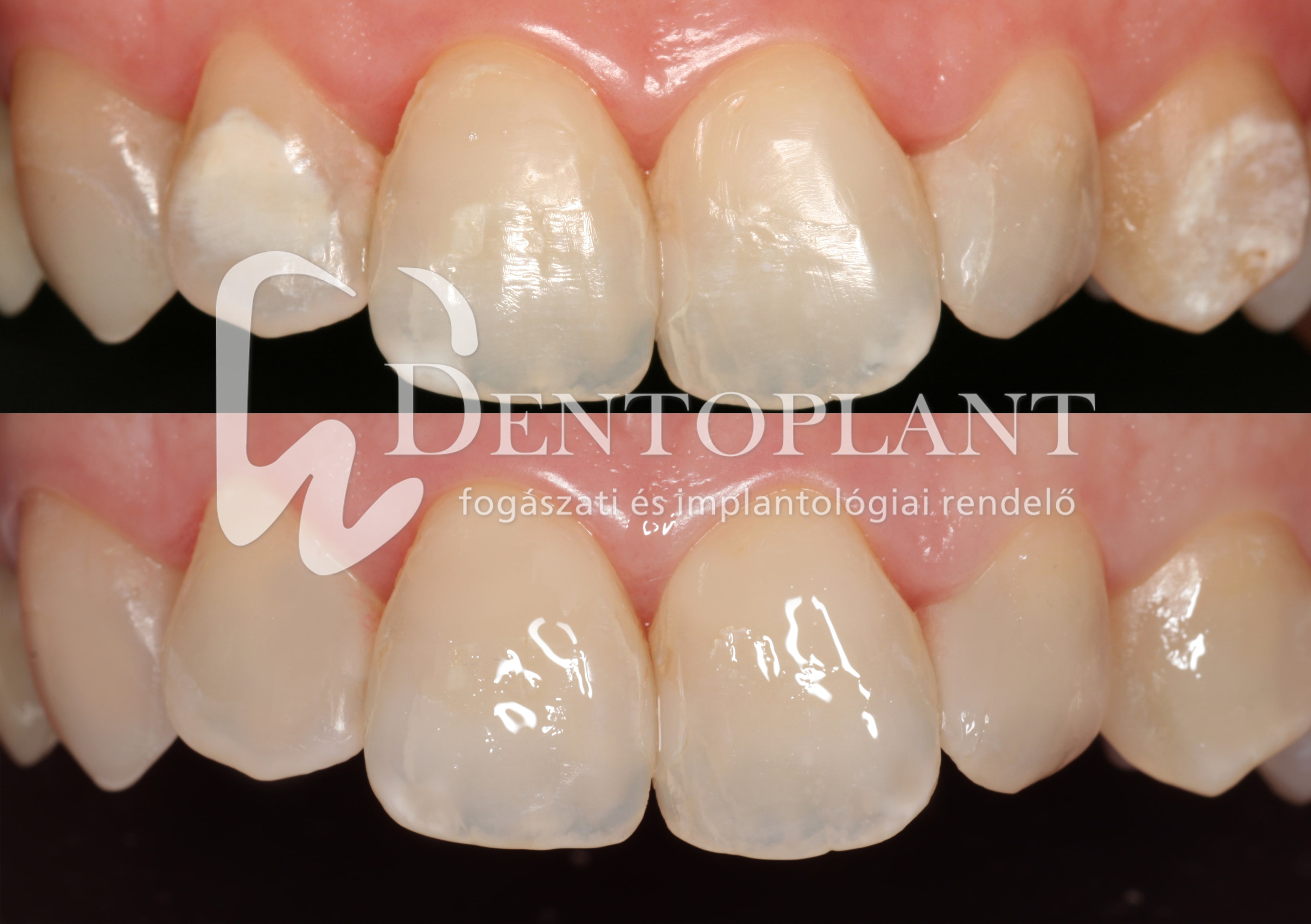 1. Dentoplant fogászat szeged ICON.logo-min