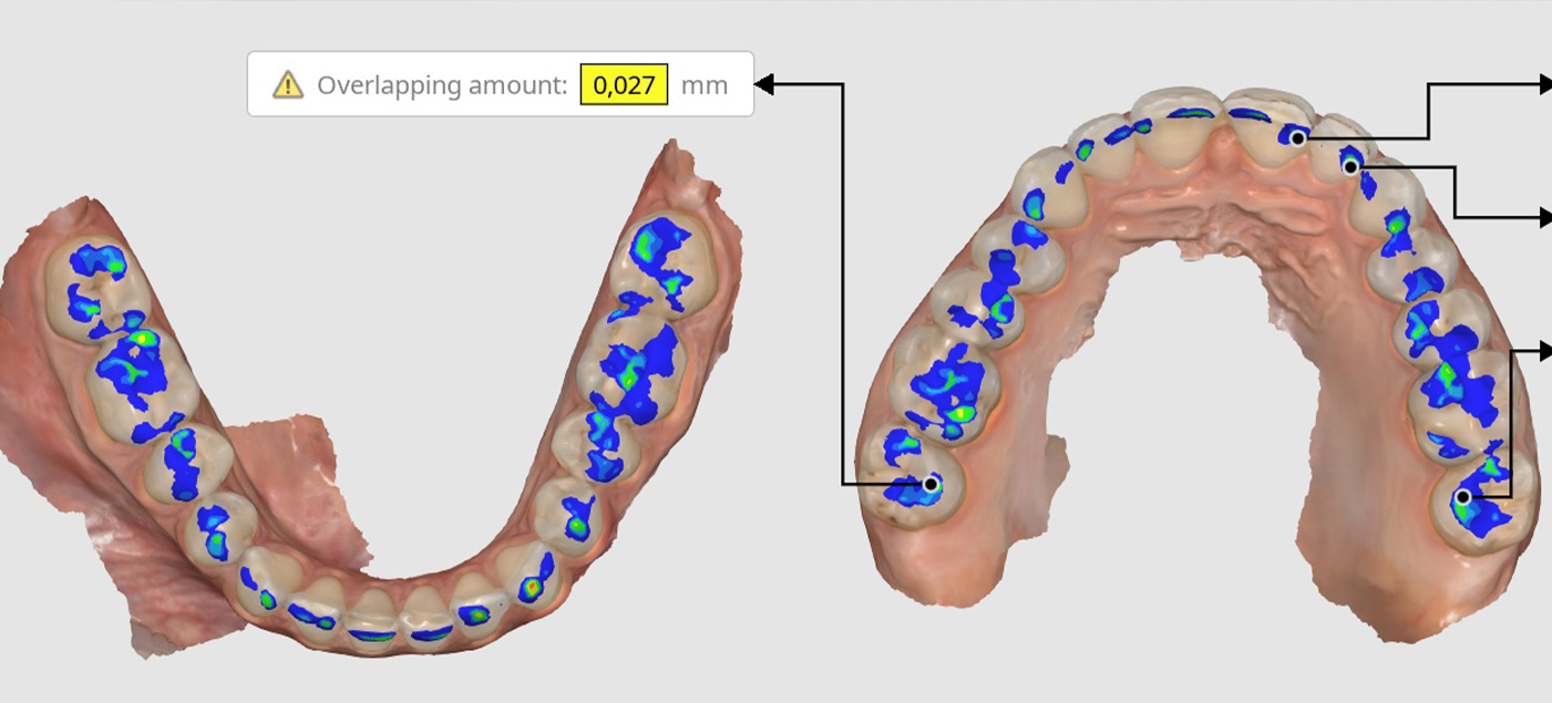 0__mosolyelemzes_dentoplant_nyiltnap